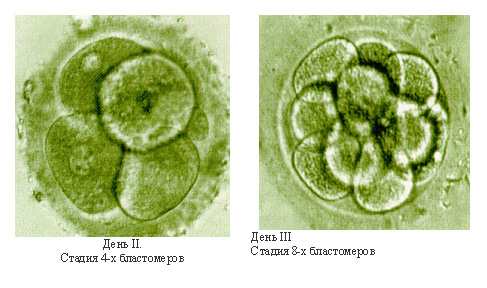 Ученые вырастили почти человеческий эмбрион. 