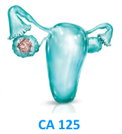 Маркер рака яичника  Са — 125